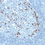 Formalin-fixed, paraffin embedded human tonsil sections stained with 100 ul anti-Kappa Light Chain (clone KLC709) at 1:50. HIER epitope retrieval prior to staining was performed in 10mM Citrate, pH 6.0.